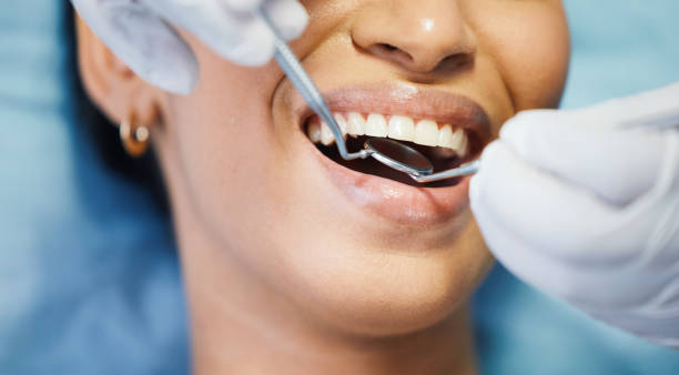 Best Emergency Dentist for Lost Fillings or Crowns in Sedona, AZ